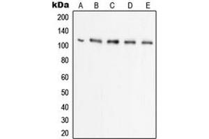 Western blot analysis of UBA7 expression in Raji (A), HL60 (B), HeLa (C), THP1 (D), A549 (E) whole cell lysates. (UBA7 antibody  (C-Term))