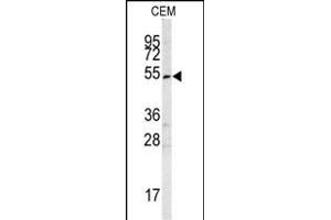 Western blot analysis of SMYD3 antibody (Center) (ABIN6242627 and ABIN6578989) in CEM cell line lysates (35 μg/lane). (SMYD3 antibody  (AA 209-236))