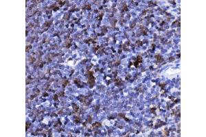 IHC analysis of CD20/MS4A1 using anti-CD20/MS4A1 antibody (ABIN7599223). (CD20 antibody  (AA 1-291))