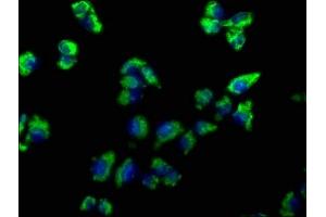 Immunofluorescence staining of Hela cells with ABIN7139819 at 1:66, counter-stained with DAPI. (EMC4 antibody  (AA 43-60))