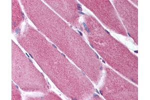 Anti-ORAI2 antibody IHC of human skeletal muscle.