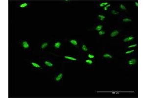 Immunofluorescence of purified MaxPab antibody to GTF2E1 on HeLa cell.