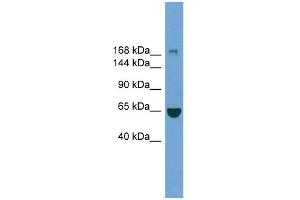WB Suggested Anti-ZCCHC11 Antibody Titration: 0.