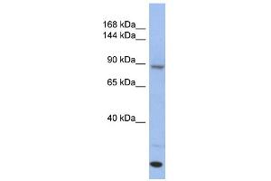 WB Suggested Anti-UNC45A Antibody Titration: 0. (UNC45A antibody  (Middle Region))