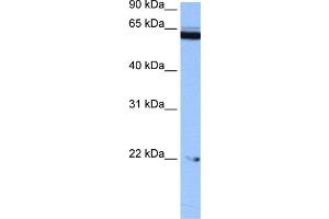 WB Suggested Anti-C14orf174 Antibody Titration: 0. (C14orf174 antibody  (N-Term))