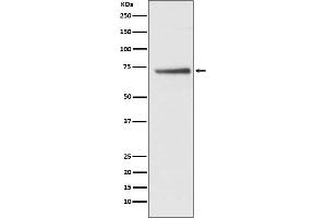 Western blot analysis of Cdc16/APC6 expression in HepG2 cell lysate. (Recombinant CDC16 antibody)