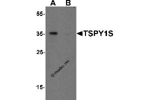 Western Blotting (WB) image for anti-TSPY1S (C-Term) antibody (ABIN1077409) (TSPY1S (C-Term) antibody)