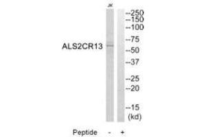 Western blot analysis of extracts from Jurkat cells, using ALS2CR13 antibody. (FAM117B antibody  (C-Term))