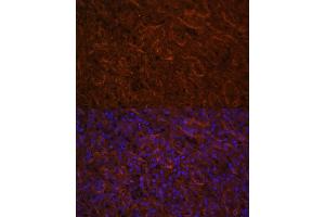 Immunofluorescence (IF) image for anti-Inducible T-Cell Co-Stimulator (ICOS) (AA 21-140) antibody (ABIN3022591)