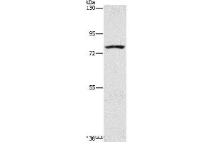 Western blot analysis of K562 cell, using SENP1 Polyclonal Antibody at dilution of 1:1500 (SENP1 antibody)