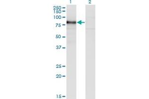 Western Blot analysis of RBM5 expression in transfected 293T cell line by RBM5 monoclonal antibody (M02), clone 3G6.