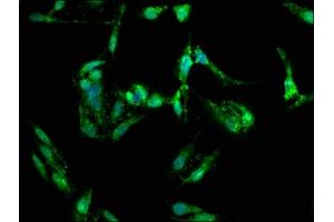 Immunofluorescence staining of Hela cells with ABIN7152837 at 1:150, counter-stained with DAPI. (FGFR3 antibody  (AA 23-375))