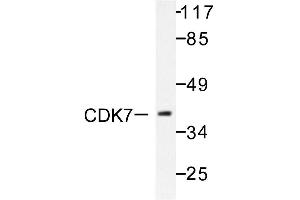 Image no. 1 for anti-Cyclin-Dependent Kinase 7 (CDK7) antibody (ABIN271945) (CDK7 antibody)