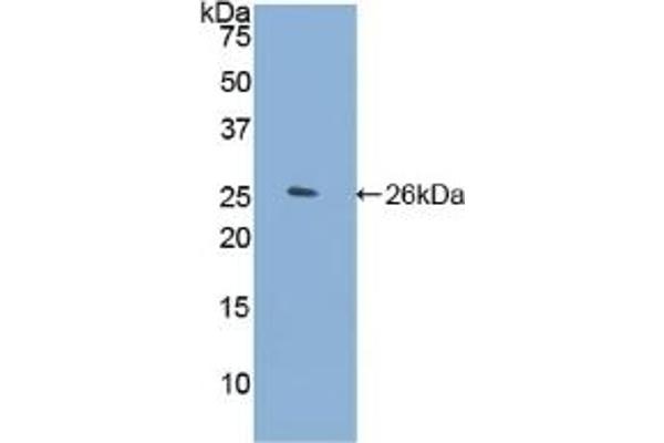 FLNC antibody  (AA 2519-2725)