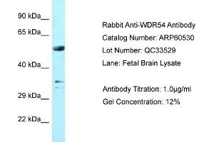 Western Blotting (WB) image for anti-WD Repeat Domain 54 (WDR54) (Middle Region) antibody (ABIN2788483) (WDR54 antibody  (Middle Region))