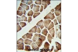 Formalin-fixed and paraffin-embedded human skeletal muscle reacted with ATP5C1 Antibody (N-term), which was peroxidase-conjugated to the secondary antibody, followed by DAB staining. (ATP5C1 antibody  (N-Term))