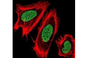 Fluorescent confocal image of HeLa cells stained with UHRF1 antibody. (UHRF1 antibody  (AA 229-257))