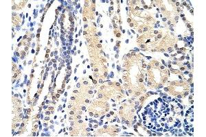 EXOSC3 antibody was used for immunohistochemistry at a concentration of 4-8 ug/ml to stain Epithelial cells of renal tubule (arrows) in Human Kidney.