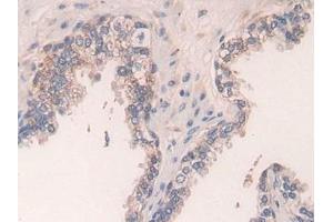 Detection of TGFb3 in Human Prostate Tissue using Polyclonal Antibody to Transforming Growth Factor Beta 3 (TGFb3)