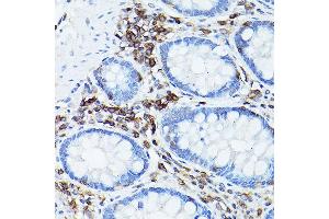 Immunohistochemistry of paraffin-embedded human colon using CD45 Rabbit pAb (ABIN3022953, ABIN3022954, ABIN3022955, ABIN1513451 and ABIN6219315) at dilution of 1:50 (40x lens). (CD45 antibody  (AA 890-990))