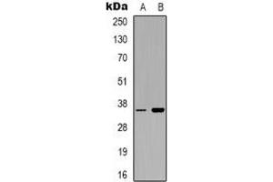 Western blot analysis of CD321 expression in Hela (A), PC12 (B) whole cell lysates. (F11R antibody)