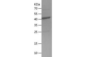 FAH Protein (AA 97-283) (His-IF2DI Tag)