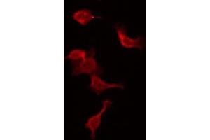 ABIN6272461 staining NIH-3T3 by IF/ICC. (WASF1 antibody  (Internal Region))