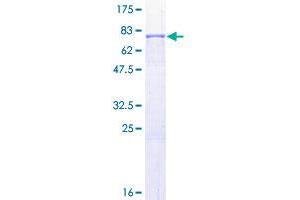 MMP1 Protein (AA 1-469) (GST tag)