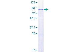 MMP1 Protein (AA 1-469) (GST tag)