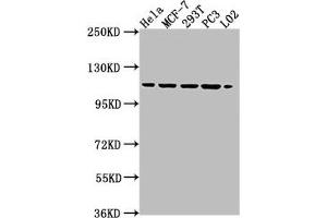 Western Blot Positive WB detected in: HeLa whole cell lysate, MCF-7 whole cell lysate, 293T whole cell lysate, PC3 whole cell lysate, L02 whole cell lysate All lanes: CSE1L antibody at 1:2000 Secondary Goat polyclonal to rabbit IgG at 1/50000 dilution Predicted band size: 111, 23, 108, 104 kDa Observed band size: 111 kDa (Exportin 2 antibody  (AA 713-971))