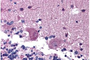 Human Brain, Cerebellum (formalin-fixed, paraffin-embedded) stained with KAL1 antibody ABIN214798 at 5 ug/ml followed by biotinylated goat anti-rabbit IgG secondary antibody ABIN481713, alkaline phosphatase-streptavidin and chromogen. (Anosmin antibody  (AA 438-454))