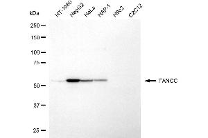Western blotting analysis using FANCC antibody (ABIN7798565).