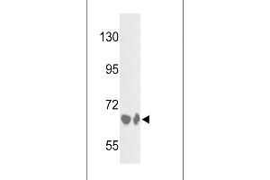 Western blot analysis of BF Antibody (Center) (ABIN391536 and ABIN2841487) in HepG2 cell line and mouse liver tissue lysates (35 μg/lane). (Complement Factor B antibody  (Center))