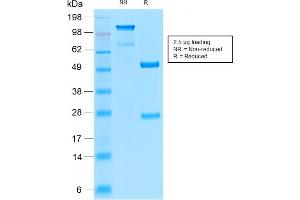 SDS-PAGE Analysis of Purified Insulin Receptor Rabbit Recombinant Monoclonal Antibody (INSR/2277R). (Recombinant Insulin Receptor antibody  (Extracellular Domain))