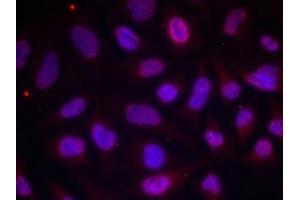 Immunofluorescence staining of methanol-fixed Hela cells using MEF2A(Phospho-Thr312) Antibody. (MEF2A antibody  (pThr312))