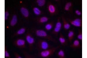 Immunofluorescence staining of methanol-fixed Hela cells using MEF2A(Phospho-Thr312) Antibody.