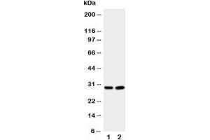 Western blot testing of Prion protein antibody and Lane 1:  rat brain;  2: rat brain.