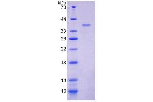 SDS-PAGE analysis of Human IL8Rb Protein. (CXCR2 Protein)