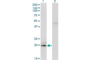 Western Blot analysis of IFNA2 expression in transfected 293T cell line by IFNA2 monoclonal antibody. (IFNA2 antibody  (AA 24-188))