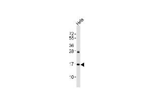 Anti p16-INK4A Antibody at 1:2000 dilution + Hela whole cell lysates Lysates/proteins at 20 μg per lane. (CDKN2A antibody  (Ser152))