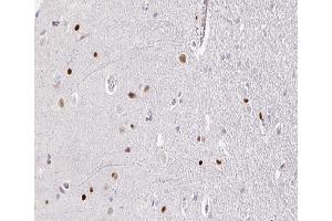 ABIN6266664 at 1/100 staining human brain tissue sections by IHC-P. (TOP2B antibody  (N-Term))