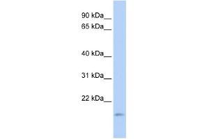 WB Suggested Anti-TNFAIP8L1 Antibody Titration: 0. (TNFAIP8L1 antibody  (Middle Region))