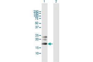 Western Blotting (WB) image for anti-Bone Marrow Stromal Cell Antigen 2 (BST2) (AA 1-180) antibody (ABIN513818)