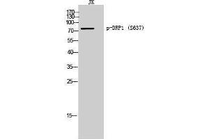 Western Blotting (WB) image for anti-Dynamin 1-Like (DNM1L) (pSer637) antibody (ABIN3182719) (Dynamin 1-Like antibody  (pSer637))