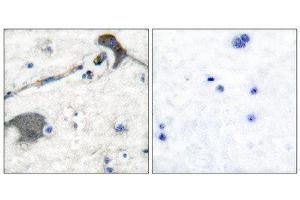 Immunohistochemistry (IHC) image for anti-RASH/RASK/RASN (N-Term) antibody (ABIN1848756) (RASH/RASK/RASN (N-Term) antibody)