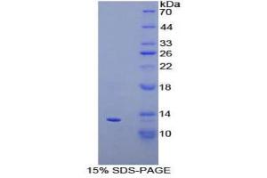 SDS-PAGE (SDS) image for Chemokine (C-X-C Motif) Ligand 10 (CXCL10) (AA 20-102) protein (His tag) (ABIN2125393)