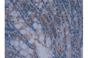 Detection of GKRP in Mouse Intestine Tissue using Polyclonal Antibody to Glucokinase Regulatory Protein (GKRP) (GCKR antibody  (AA 17-261))