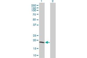 Western Blot analysis of NME1 expression in transfected 293T cell line by NME1 MaxPab polyclonal antibody. (NME1 antibody  (AA 1-177))