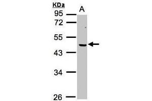 WB Image Sample (30μg whole cell lysate) A:MOLT4 , 10% SDS PAGE antibody diluted at 1:1000 (ERCC8 antibody  (Center))