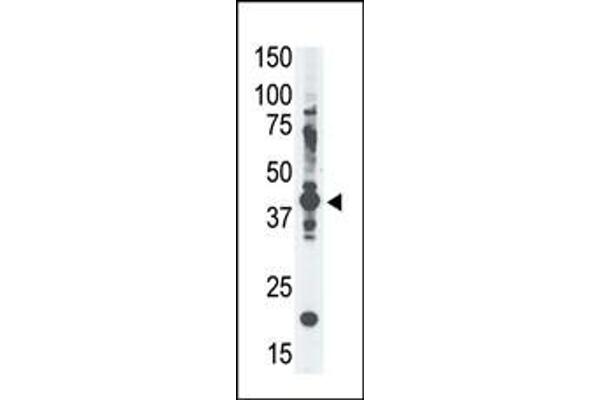 MAGEA4 antibody  (N-Term)